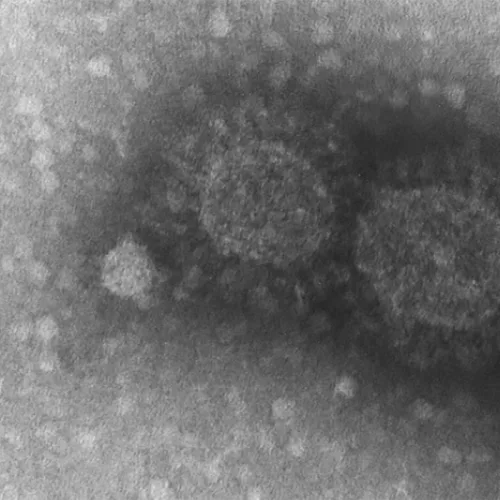 Divulgada sequência genética do novo coronavírus dois dias depois de surgir o primeiro caso no Brasil. Foto: Instituto Adolfo Lutz
