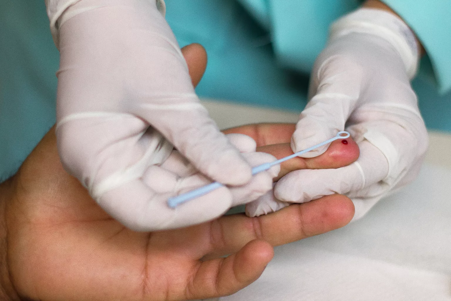 Vigilância Em Saúde Do Estado Monitora Três Casos De Hepatite Aguda Infantil De Origem 7881