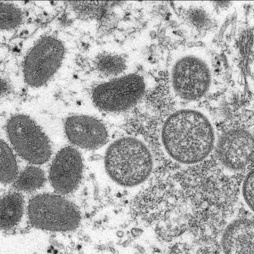 Imagem de microscópio mostra vírus causador da varíola do macaco. Crédito: Cynthia S. Goldsmith, Russell Regner/CDC 