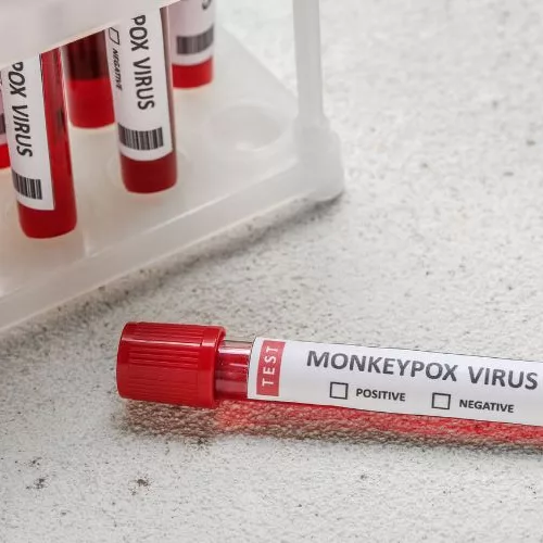 Teste de Varíola dos macacos (Foto: Banco de imagens Canva)