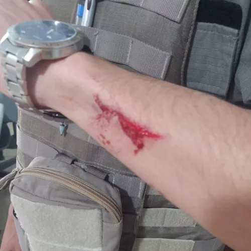 Policial foi ferido após abordagem a homem em local de votação. Foto: Brigada Militar / Divulgação